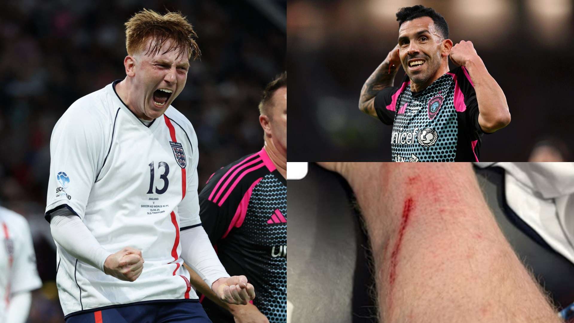 តេវ៉េស ត្រូវបានហៅថា “ឆ្កួត” ដោយ Angry Ginge ក្រោយការប៉ះទង្គិចនៅ Soccer Aid